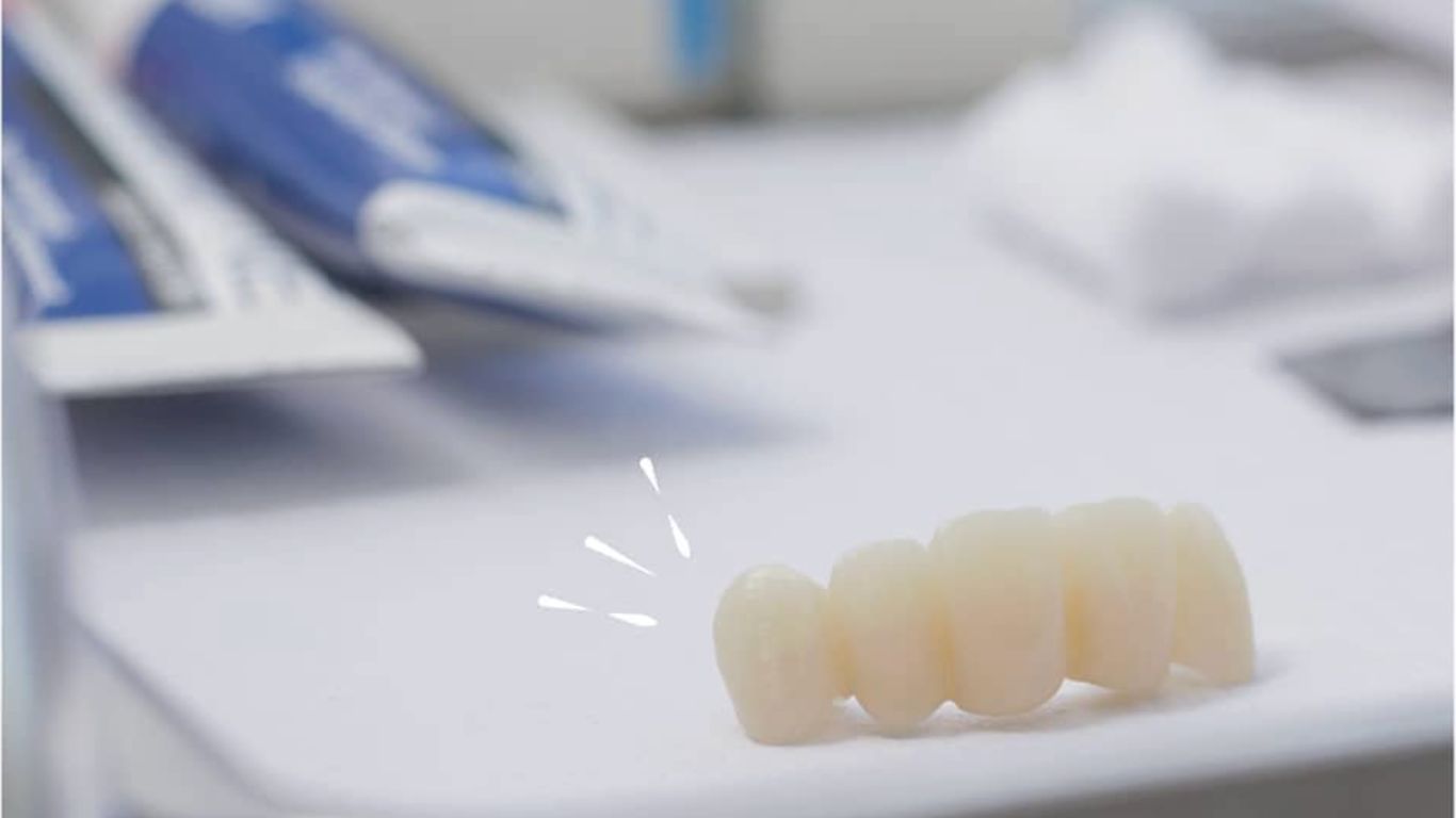 Implantes dentales: una solución segura y duradera